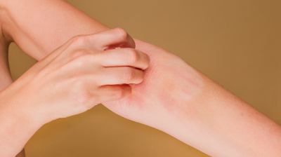 Andrej Medveď - Koľko ešte vydržíte, kým začnete riešiť problém atopickej pokožky inak, než len zvonku?